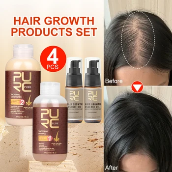 PURC Средства для быстрого роста волос Имбирный шампунь-кондиционер, Масло для волос, Спрей От выпадения, Загуститель Для кожи головы, Уход за волосами, 4 шт.